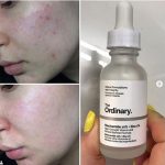 سرم نیاسینامید اوردینری اصل 30 میل - Image 2