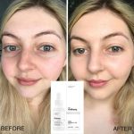سرم ضدلک آلفا آربوتین 2% + هیالورونیک اسید اوردینری 30ml - Image 3