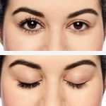 ریمل فولسایز کلینیک - Image 2