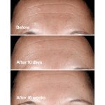 سرم ترمیم کننده و ضد چروک اسمارت کلینیک 10میل - Image 3
